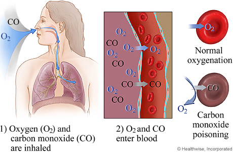 A diagram showing how Carbon Monoxide poisoning works A diagram showing how Carbon Monoxide poisoning works